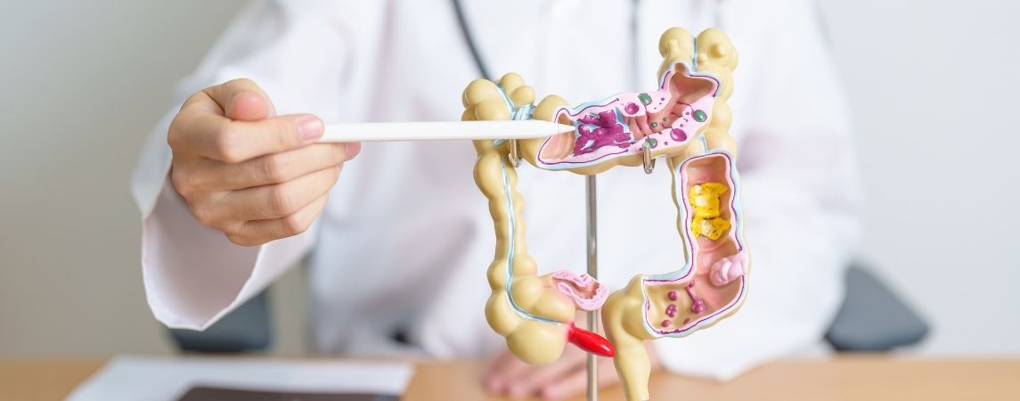 50 Yaş Üstü ve Kiloluysanız Risk İki Kat: Kolon Kanseri Sessizce İlerliyor