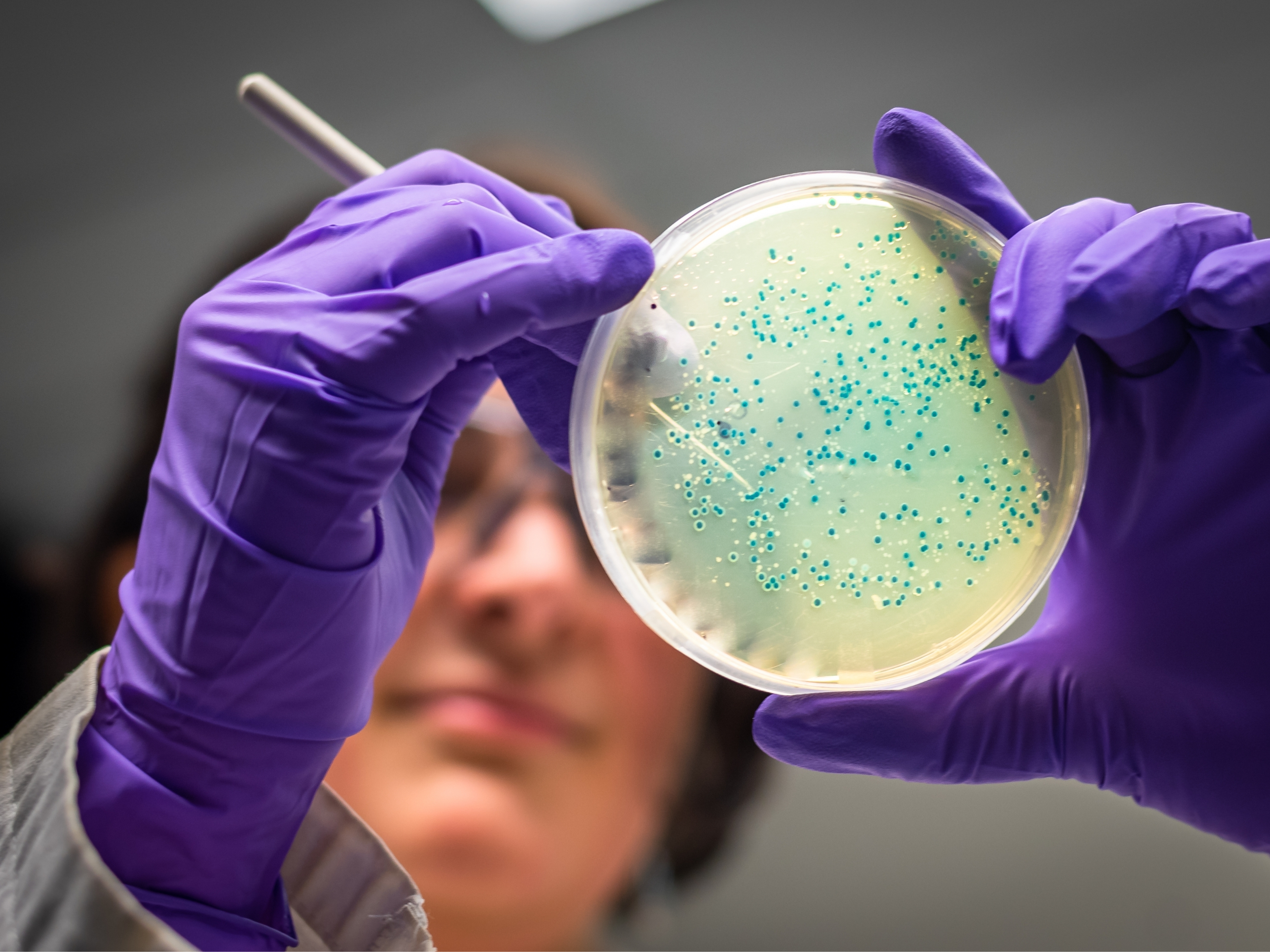 K&ouml;t&uuml; Anılar Artık Silinebilecek